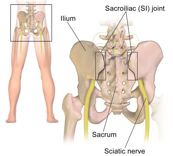 Looking to relieve that sciatic nerve pain? Firstly, you need to understand how sciatic nerve pain come about. (wiki commons)